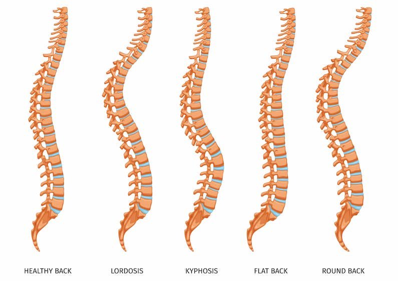 spine alignment posture